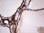 KRT19 Antibody in Immunohistochemistry (Paraffin) (IHC (P))