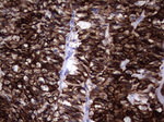KRT19 Antibody in Immunohistochemistry (Paraffin) (IHC (P))