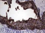 KRT19 Antibody in Immunohistochemistry (Paraffin) (IHC (P))