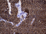KRT19 Antibody in Immunohistochemistry (Paraffin) (IHC (P))