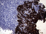 KRT19 Antibody in Immunohistochemistry (Paraffin) (IHC (P))