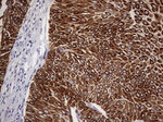 KRT19 Antibody in Immunohistochemistry (Paraffin) (IHC (P))