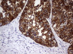 KRT19 Antibody in Immunohistochemistry (Paraffin) (IHC (P))