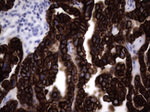 KRT19 Antibody in Immunohistochemistry (Paraffin) (IHC (P))