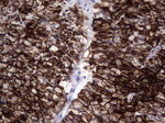 KRT19 Antibody in Immunohistochemistry (Paraffin) (IHC (P))