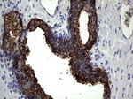 KRT19 Antibody in Immunohistochemistry (Paraffin) (IHC (P))