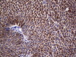 KRT19 Antibody in Immunohistochemistry (Paraffin) (IHC (P))