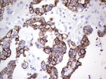 KRT19 Antibody in Immunohistochemistry (Paraffin) (IHC (P))
