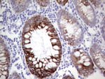 KRT19 Antibody in Immunohistochemistry (Paraffin) (IHC (P))