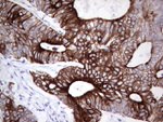 KRT19 Antibody in Immunohistochemistry (Paraffin) (IHC (P))