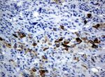 KRT19 Antibody in Immunohistochemistry (Paraffin) (IHC (P))