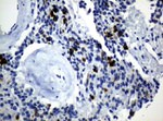 KRT19 Antibody in Immunohistochemistry (Paraffin) (IHC (P))