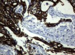 KRT19 Antibody in Immunohistochemistry (Paraffin) (IHC (P))