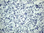 KRT19 Antibody in Immunohistochemistry (Paraffin) (IHC (P))