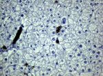 KRT19 Antibody in Immunohistochemistry (Paraffin) (IHC (P))