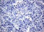 KRT19 Antibody in Immunohistochemistry (Paraffin) (IHC (P))