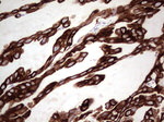 KRT19 Antibody in Immunohistochemistry (Paraffin) (IHC (P))