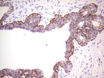 KRT19 Antibody in Immunohistochemistry (Paraffin) (IHC (P))