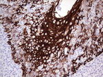 KRT19 Antibody in Immunohistochemistry (Paraffin) (IHC (P))