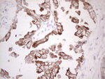 KRT19 Antibody in Immunohistochemistry (Paraffin) (IHC (P))
