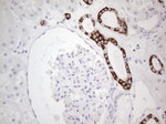 KRT19 Antibody in Immunohistochemistry (Paraffin) (IHC (P))