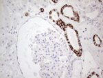 KRT19 Antibody in Immunohistochemistry (Paraffin) (IHC (P))