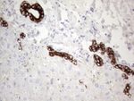 KRT19 Antibody in Immunohistochemistry (Paraffin) (IHC (P))