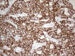 KRT19 Antibody in Immunohistochemistry (Paraffin) (IHC (P))