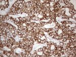 KRT19 Antibody in Immunohistochemistry (Paraffin) (IHC (P))