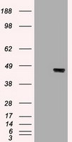 KRT19 Antibody in Western Blot (WB)