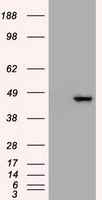 KRT19 Antibody in Western Blot (WB)