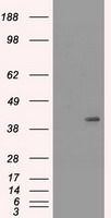 KRT19 Antibody in Western Blot (WB)