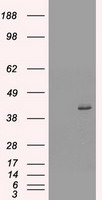KRT19 Antibody in Western Blot (WB)