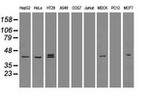 KRT19 Antibody in Western Blot (WB)