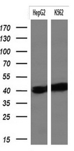 KRT19 Antibody in Western Blot (WB)