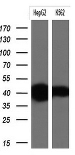 KRT19 Antibody in Western Blot (WB)
