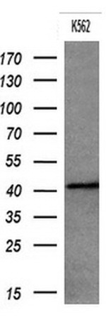 KRT19 Antibody in Western Blot (WB)