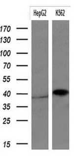 KRT19 Antibody in Western Blot (WB)