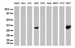 KRT19 Antibody in Western Blot (WB)