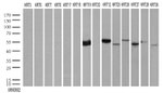 KRT19 Antibody in Western Blot (WB)