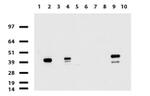 KRT19 Antibody in Western Blot (WB)