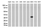 KRT19 Antibody in Western Blot (WB)