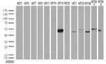 KRT19 Antibody in Western Blot (WB)