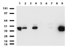 KRT19 Antibody in Western Blot (WB)