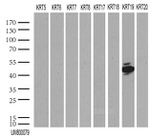 KRT19 Antibody in Western Blot (WB)