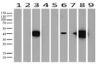 KRT19 Antibody in Western Blot (WB)