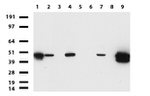 KRT19 Antibody in Western Blot (WB)