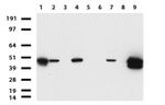 KRT19 Antibody in Western Blot (WB)