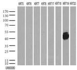 KRT19 Antibody in Western Blot (WB)