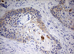 KRT20 Antibody in Immunohistochemistry (Paraffin) (IHC (P))